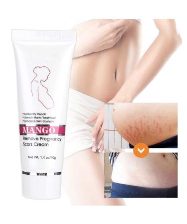 Crema Para Las Estrias, Stretch Mark Cream Repair Cream Scars Acne Cream Pregnancy Scar Treatment Maternity Repair