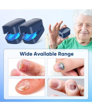 Nail Fungus Laser Treatment Device - 2 Pack for Onychomycosis | Effective Therapy for Discolored, Brittle Nails | Home Use for Fingernails & Toenails - Blue - Buy Online on GoSupps.com