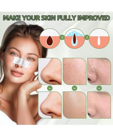  SONGVISON Pack of 60 blackhead removal strips (30g) - To remove blackheads and open pores - For all skin types - For men and women - Buy Online on GoSupps.com