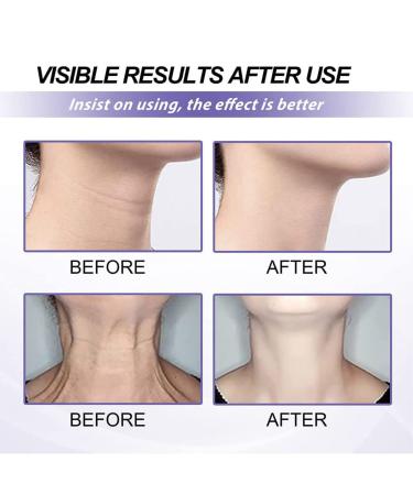 2PCs Retinol Neck Cream | Anti-Aging Moisturizer & Skin-Tightening Collagen Formula for Double Chin - Buy Online on GoSupps.com
