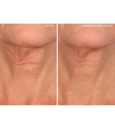 SiO Beauty Plunging Neckline - Overnight Silicone Smoothing Patches for Neck & Chest | Reusable SkinPad & Necklift - Shop Now - Buy Online on GoSupps.com