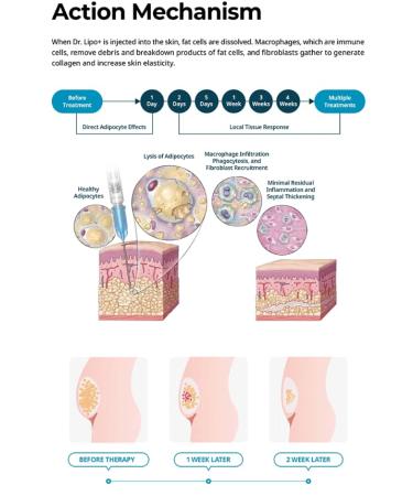 Dr. Lipo+ Fat Dissolving Injection 10ml x 10 Vials - Body Contouring Solution - Buy Online on GoSupps.com