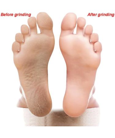 Double-Sided Foot File 6pcs Foot Rasp Files Disposable Foot Rasp Manicure File Callus Hard Skin Remover - Buy Online on GoSupps.com