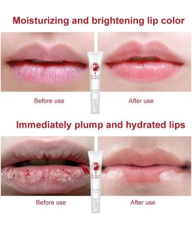 BEROZA Lip Balm Pink Lips Lightening Treatment Fresh Pink Lip Balm Whitening Cream Lighten Dark Lips Lip Care 18ml (1pcs) - Buy Online on GoSupps.com