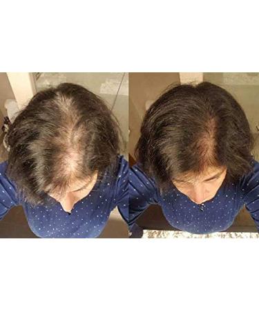 Zenagen Revolve Thickening Hair Loss Shampoo for Women - 6 Fl Oz - Buy Online on GoSupps.com