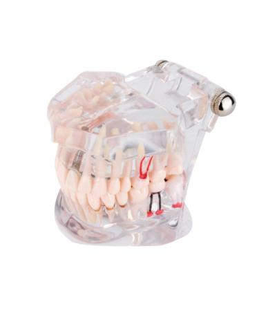 Cocoarm Removable Tooth Model - Dental Care Demo Tool for Teaching Study & Implant Education - Buy Online on GoSupps.com