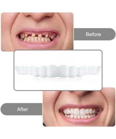 Natural Shade Fake Teeth Veneers for Upper & Lower Jaw - Perfect Braces & Whitening Substitutes - Buy Online on GoSupps.com