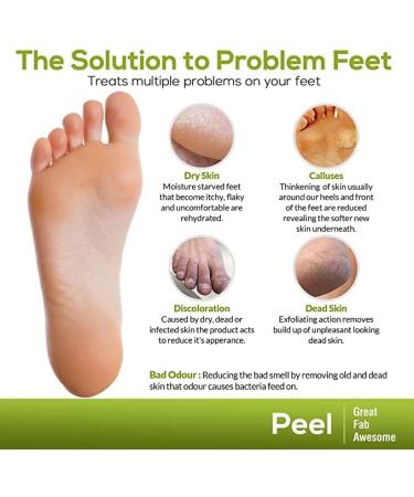 Foot Peel Mask Footner Exfoliating WOOZHI 2 Pack -Dermatologically Tested - Repair Heels & Removes Dry Dead Skin for Soft Baby Feet - Buy Online on GoSupps.com