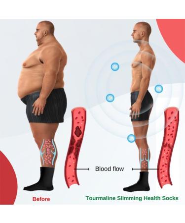 Tomalin Acupressure Self-Heating Shaping Socks - 4PCS-B | Magnetic Tourmaline Slimming & Foot Massage Therapeutic Socks for Health & Wellness | International Shipping Available - Buy Online on GoSupps.com