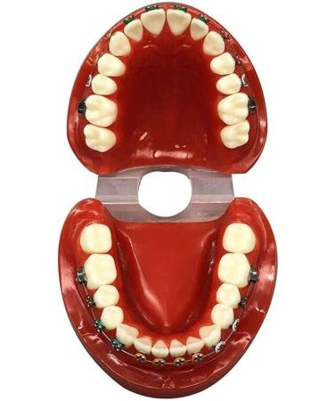 Orthodontic Teeth Model Dental Typodont with Metal Brackets & Ligature Ties - Red | International Shipping Available - Buy Online on GoSupps.com