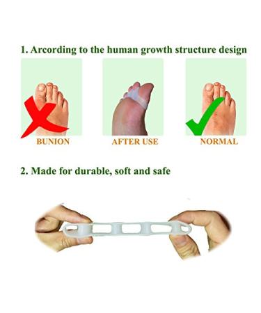 APASIN Toe Separators & Straighteners for Bunion Pain Relief - Foot Spacers for Yoga, Running & Sports Activities (White, 1 Pair) - Buy Online on GoSupps.com