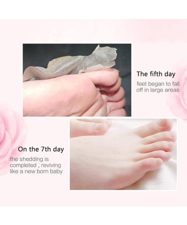 Allbestaye Rose Feet Peeling Foot Mask | Exfoliating Socks for Pedicure & Dead Skin Remover Foot Care Solution for Calluses - Buy Online on GoSupps.com