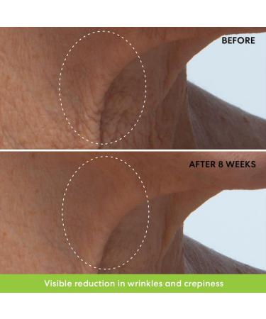 Buy bareMinerals Ageless Phyto-Retinol Neck Cream | Vegan Anti-Aging & Anti-Wrinkle Formula with Plant-Based Retinol & Hyaluronic Acid - International Shipping Available - Buy Online on GoSupps.com