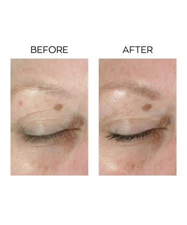 Anew Lifting Dual Eye System | Anti-Aging & Anti-Wrinkle Eye Cream - Buy Online on GoSupps.com
