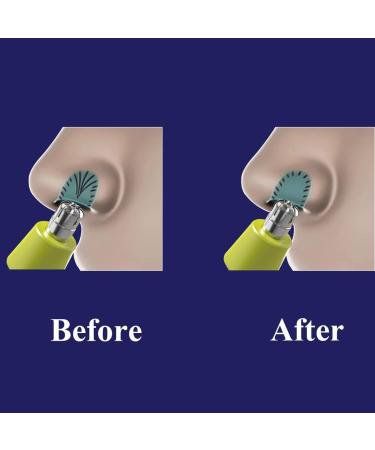 Fallensmile Nose Hair Trimmer Replacement Blades - 2 Pack for One Blade Shavers & Trimmers | Nose & Ear Hair Attachments - Buy Online on GoSupps.com