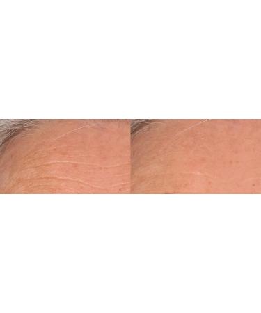 Nakery Skip the Line Instant Wrinkle Eraser - Visibly Reduces Wrinkles & Fine Lines Instantly - Buy Online on GoSupps.com