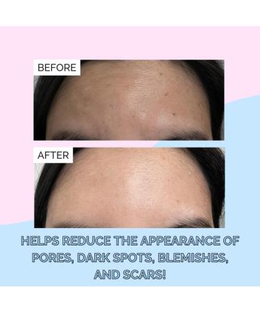 Elizabeth Mott Snail Mucin Face Serum - Deep Moisture Hydrating Skincare for Clear Skin 97% Snail Secretion Combats Dullness & Fine Lines Cruelty-Free 100ml - Buy Online on GoSupps.com