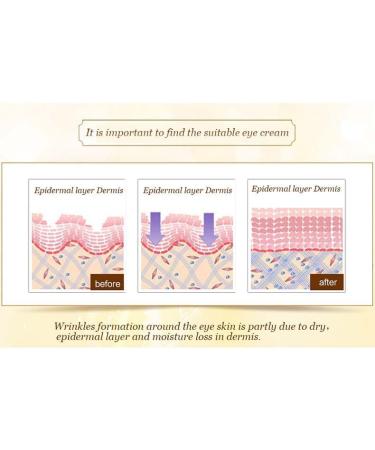 YIXIXI Hyaluronic Acid Eye Gel Patches - Reduce Dark Circles, Eye Bags, and Wrinkles - 10 Pairs - Buy Online on GoSupps.com