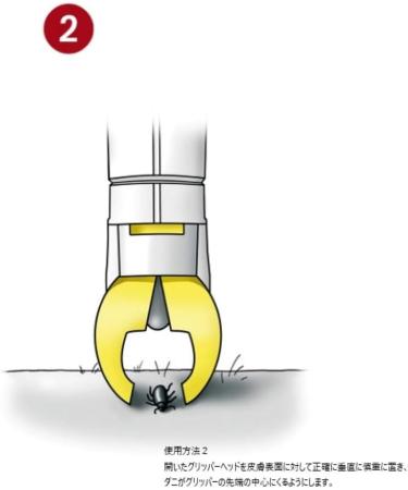 tickSAFE Tick Remover - Human | Safe and Effective Tick Removal Tool - Buy Online on GoSupps.com