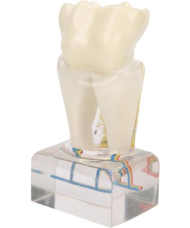 Professional Dental Nerve Model for Teaching | Resin Tooth Model for Students | International Shipping - Buy Online on GoSupps.com