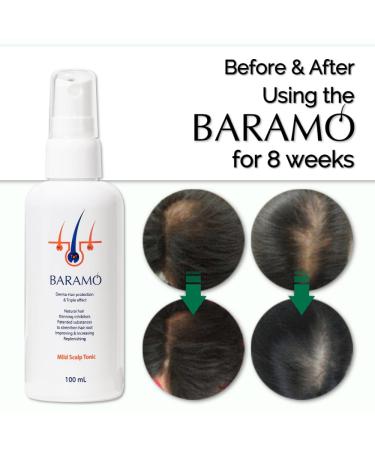 BARAMO DHT Blocker Scalp Tonic for Hair Growth - 14+ Botanical Ingredients - Men & Women (3.4 Fl Oz) - Buy Online on GoSupps.com