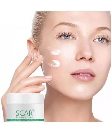 Hotiary Plant Scar Repair Cream - Acne & Stretch Mark Remover for Scars, Burns, Postoperative Skin - Men & Women - Buy Online on GoSupps.com