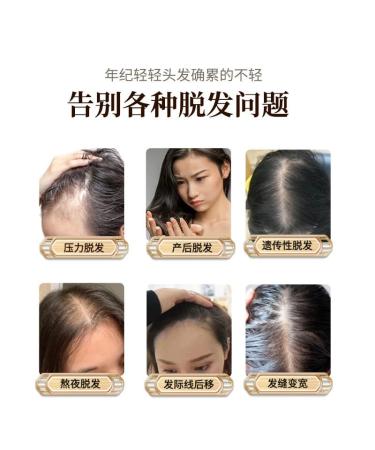 Smooth Oil Control Anti Hair Loss Shampoo - Nourishing Plant Extract Formula for Unisex - 1 Count - Buy Online on GoSupps.com