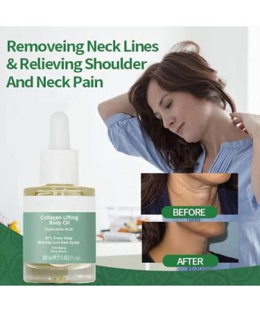 BeautyLady Advanced Collagen Lifting Body Oil 29.7 g BeautyLady Advanced Collagen Lifting Body Oil Advanced Deep Anti-Wrinkle Serum (1 piece) - Buy Online on GoSupps.com