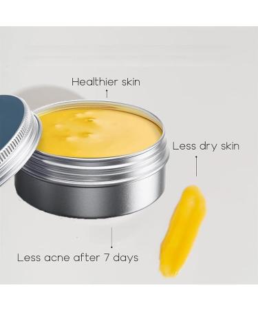 Organics Anti-Acne & Redness Skin Care Kit Natural & Gentle Formula Anti-Acne Cream for Teens & Adults Anti-Acne Balm for All Skin Types (2pcs) - Buy Online on GoSupps.com
