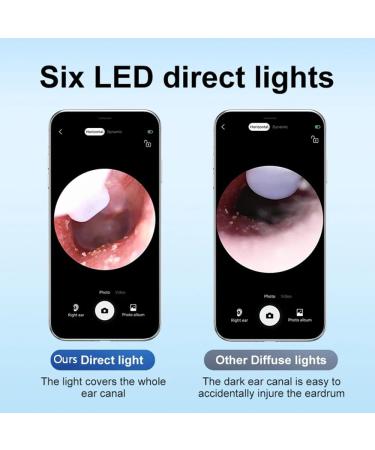 Ear Wax Removal Soufyuane Ear Cleaner with Upgraded 1080p Camera Ear Wax Removal Kit Ear Camera Otoscope with Light Ear Cleaning Kit for iPhone iPad Android Phones (White) - Buy Online on GoSupps.com