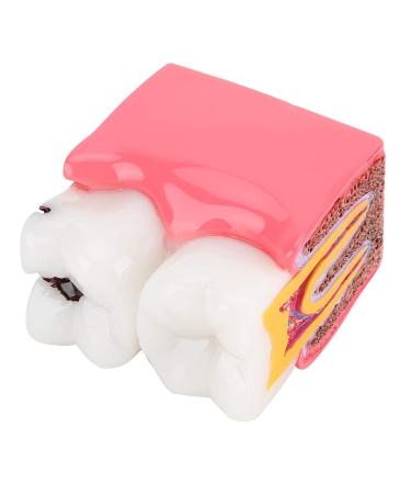 High-Quality Dental Prosthesis Model for Oral Care | International Shipping Available - Buy Online on GoSupps.com