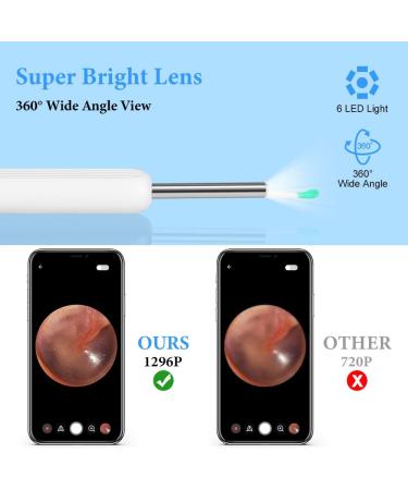 ACWOO Ear Wax Remover - 1296P HD Wireless Ear Wax Removal Kit with Camera - Visual Otoscope Ear Cleaner for Adults, Kids & Pets - Buy Online on GoSupps.com