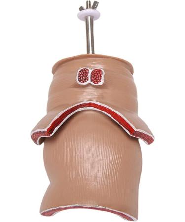 Hemorrhoid Lesion Model Human Rectal Pathological Anatomy Model Internal Model of Hemorrhoids External Model of Hemorrhoids Anal Model Tool Teaching - Buy Online on GoSupps.com