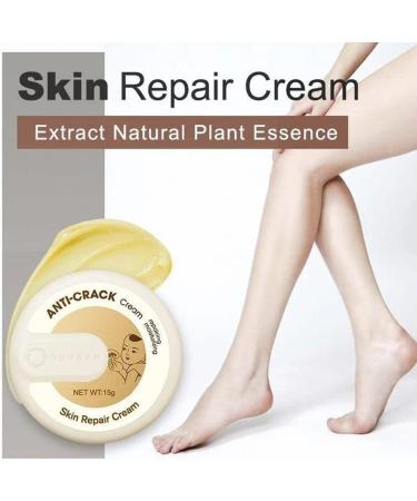 Suho Skin Healing Ointment for Cracked Heels & Dry Feet | Best Anti-Crack Hand & Foot Cream | Repair Calluses & Dead Skin - International Shipping - Buy Online on GoSupps.com