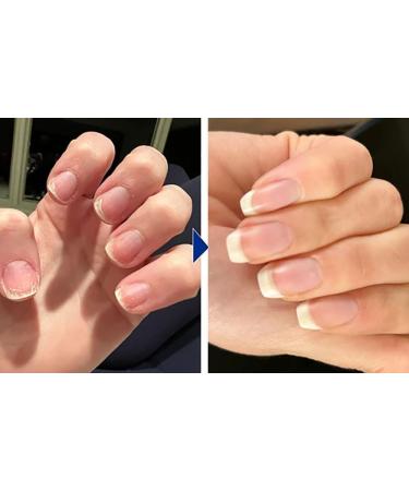 Biancat OnyxoGuard Nail Growth and Repair Serum OnyxoGuard Serum Nail Growth Serum Nail Growth and Strengthener Nail Serum Repair Essence Nail Strengthener for Thin Nails and Growth (2pcs) - Buy Online on GoSupps.com