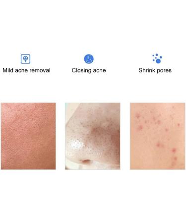 Skin Repair Cotton Pads - 60 Pieces | 0.5% Blackhead & Acne Removal | Gentle Facial Cleaning Towels - Buy Online on GoSupps.com
