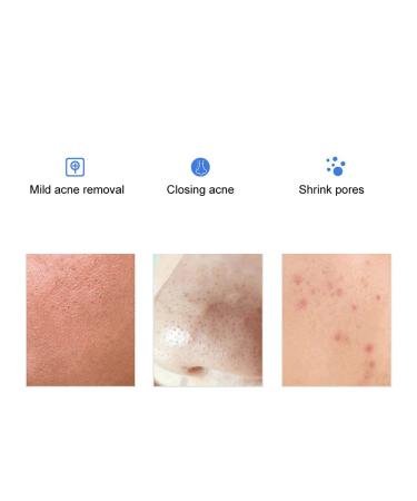 Sonew 60pcs Salicylic Acid Cotton Pads - Acne Removal & Pore Shrink Treatment International Shipping - Buy Online on GoSupps.com