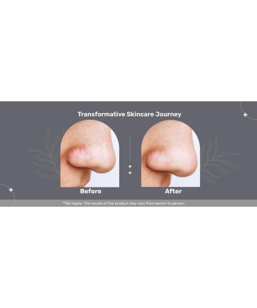 Skin Perfecting AHA-BHA Serum | 30% AHA 2% BHA 5% PHA - Clear Acne Exfoliate & Regenerate Skin - Paraben Free - 1 Fl Oz - Buy Online on GoSupps.com