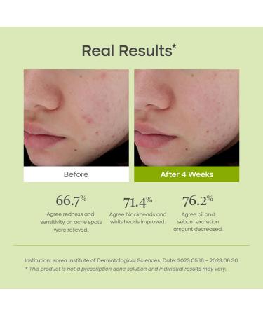 PURITO Clear Code Superfruit Serum 30ml | Next-Gen Clarifying Solution with Noni Extract | Vegan & Cruelty-Free | Ideal for Sensitive Skin | Korean Skincare International Shipping - Buy Online on GoSupps.com