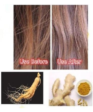 100% Authentic Andrea Hair Growth Essence 20ml - Dense Hair Growth Serum - Buy Online on GoSupps.com