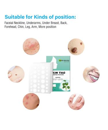 Chiffon Hair Gums & Loops - 14-Piece Set with Flower Motifs for Women - Ponytail Accessories in 8 Colors & 6 Solids - Buy Online on GoSupps.com