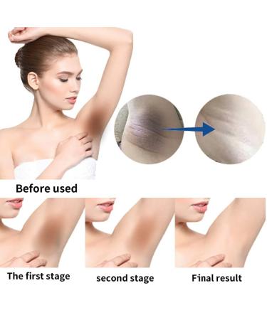 Skin Lightening Cream for Underarms, Knees, Elbows, Thighs, Bikini Line | USA-Made, Permanent Whitening, Dark Spot Remover - Buy Online on GoSupps.com