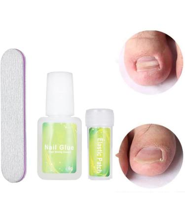 Ingrown Toenail Patch Correction Kit Elastic Toe Nail Straightener Patch with Nail File Glue Ingrown Toenail Pedicure Tool Kit - Buy Online on GoSupps.com