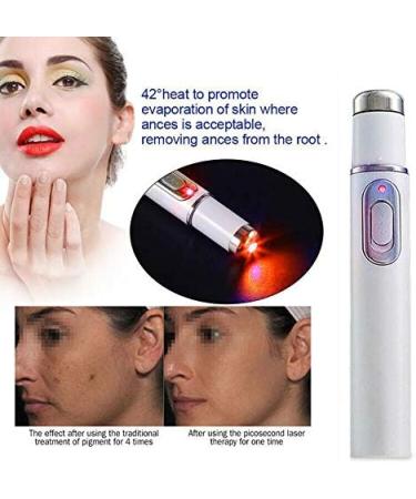 Spot Treatments Pen Red-Ray Ance Remover Therapy|Removal Picosecond Pen|Acne Spot Laser Pen Soft Scar Wrinkle Removal Device Activate Skin/Tighten Loosen Skin - Buy Online on GoSupps.com