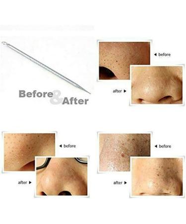 36 Acne Pimple Spot Zit Patches Face Treatment Stickers Pimple Cover Invisible Hydrocolloid Absorbing Cover Up Covering Healing Patch for Concealer Blemish Care + Free Blackhead Zit Remover Tool - Buy Online on GoSupps.com