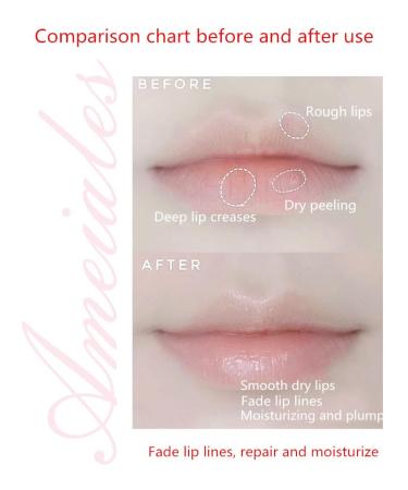 Charming Water Moisturizing Lip Honey - Hydrating & Nourishing Lip Care for All Skin Types | Shop Internationally - Buy Online on GoSupps.com