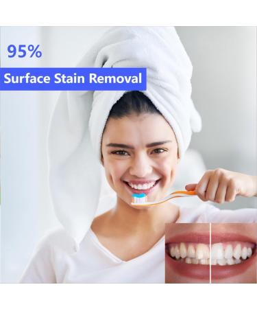 BodyAccel Teeth Whitening Toothpaste - Fluoride-Free Deep Clean for Cavity Repair & Fresh Breath | Removes Tea Coffee & Wine Stains - Cherry Flavor 3.5 oz - Buy Online on GoSupps.com