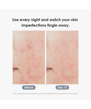 glowiest EFFORTLESS GLOW PDRN + Spicule Cream I Daily Face Moisturizer I Premium Salmon PDRN I Recovery & Moisture with Niacinamide PDRN & Spicule l Korean Skin Care for All Skin Types - Buy Online on GoSupps.com