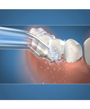 Dental Water Jet Pik Pocket Replacement Tips - 2pcs for Waterpik Oral Irrigator (Pocket Tips) - Compatible with Wp-100, Wp-450, Wp-250, Wp-300, Wp-660, Wp-900 - Buy Online on GoSupps.com