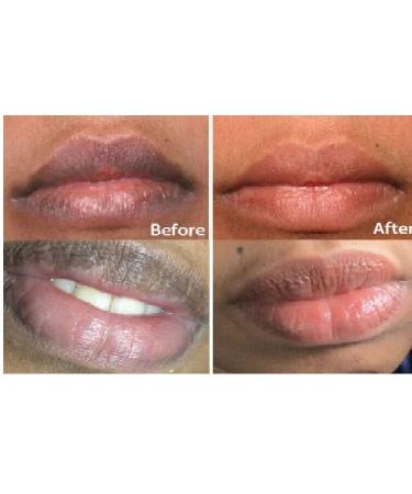 ZWSP 2PCS New Pure Natural Herbal Medicine Lightening Lip Black Removal Lip Balm Eliminate Uneven Darkness on Lips Treatment Fast Results - Buy Online on GoSupps.com
